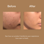 Anti Acne & Oil Control Facewash
