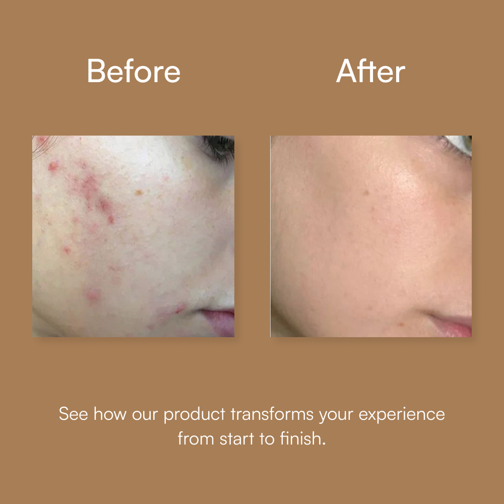 Hyaluronic Acid Serum