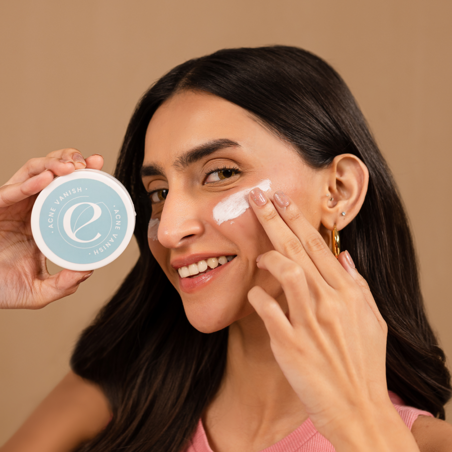 Acne Vanish Cream