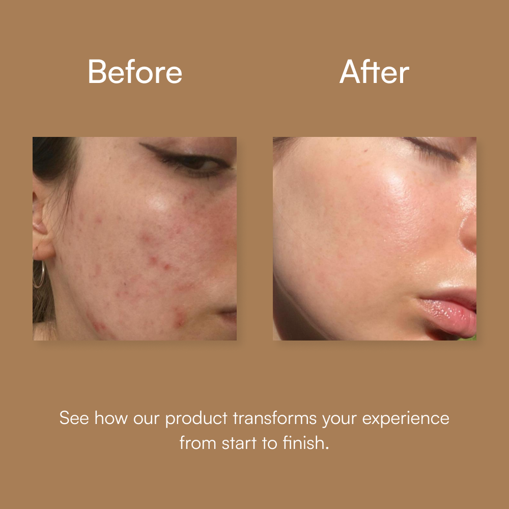 Renewing SA Cleanser